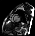 HD CARDIAC IMAGING