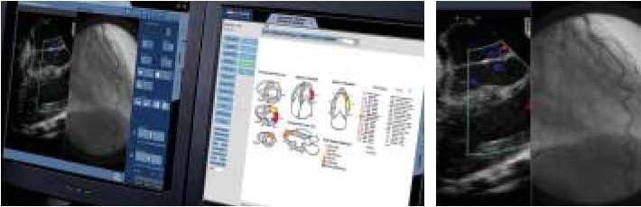 PACS (Picture archiving and communication system) - Agfa IMPAX